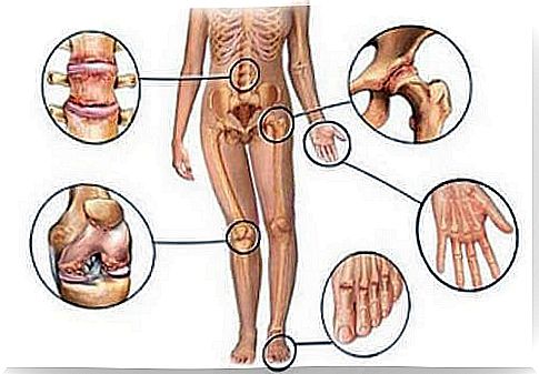 5 natural anti-inflammatory ingredients for joint pain