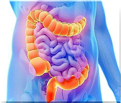 colon cancer