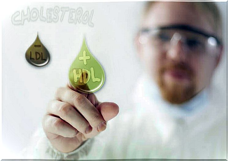 Good cholesterol (HDL)