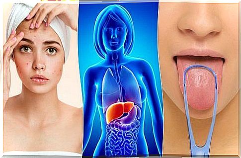 7 signs that the liver is overflowing with toxins