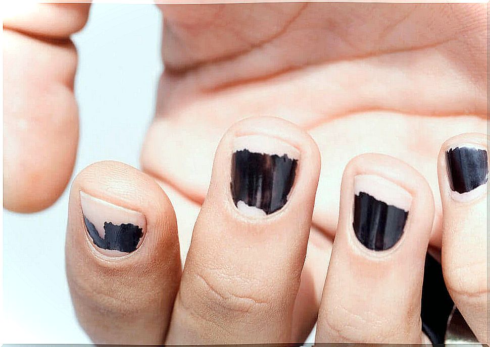 Improper removal of nail polish can be a cause of brittle nails