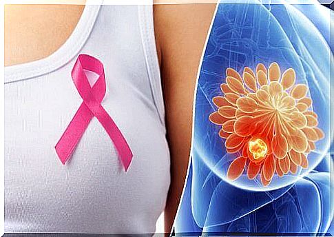 A pill to detect breast cancer.  Does it work?