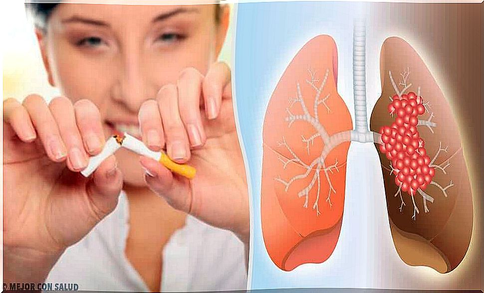 Causes and diagnosis of lung cancer