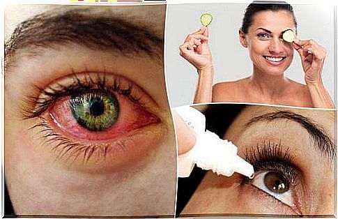 Dry eye syndrome: How to fight it naturally