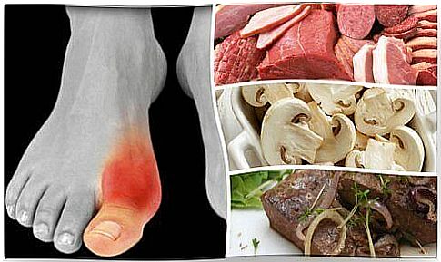 Foods those with gout must avoid eating