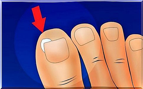 This is how you can prevent ingrown nails