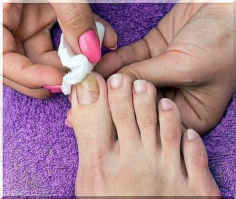 toenails