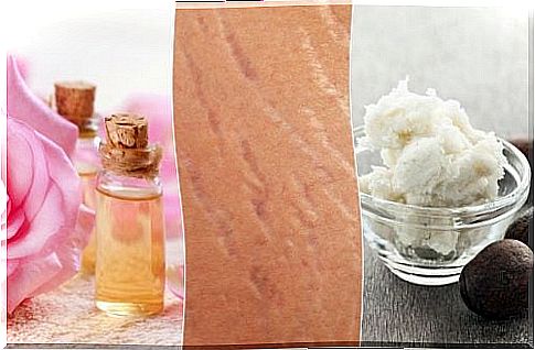 Make your stretch marks less noticeable 4 natural treatments