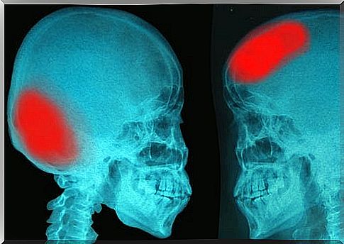 Draw a stroke you should know about