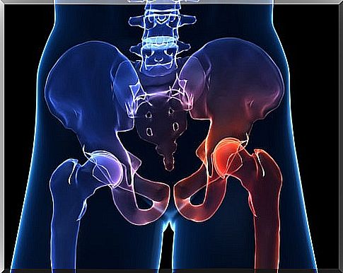 Symptoms of hip joint wear and how to prevent it