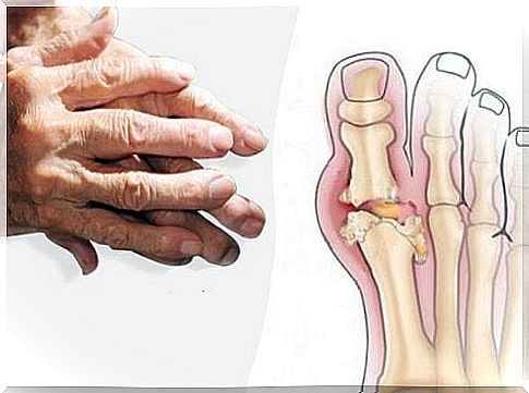 2-arthritis