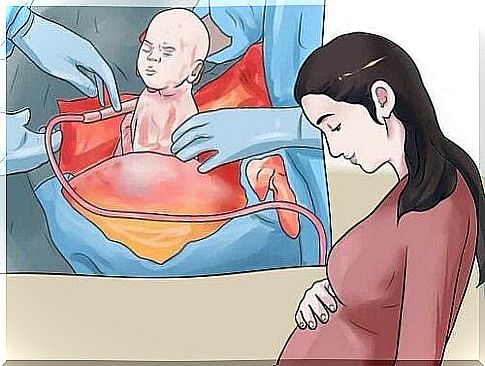 The fear of childbirth performed by caesarean section