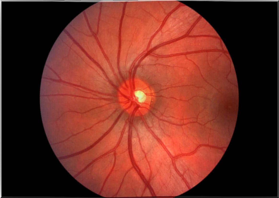 The fundus of the island